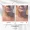 Dailyglowspa_Before_and_After_Body_Contouring_One_in_San_Diego_CA