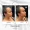Dailyglowspa_Before_and_After_Dermal_Fillers_One_in_San_Diego_CA