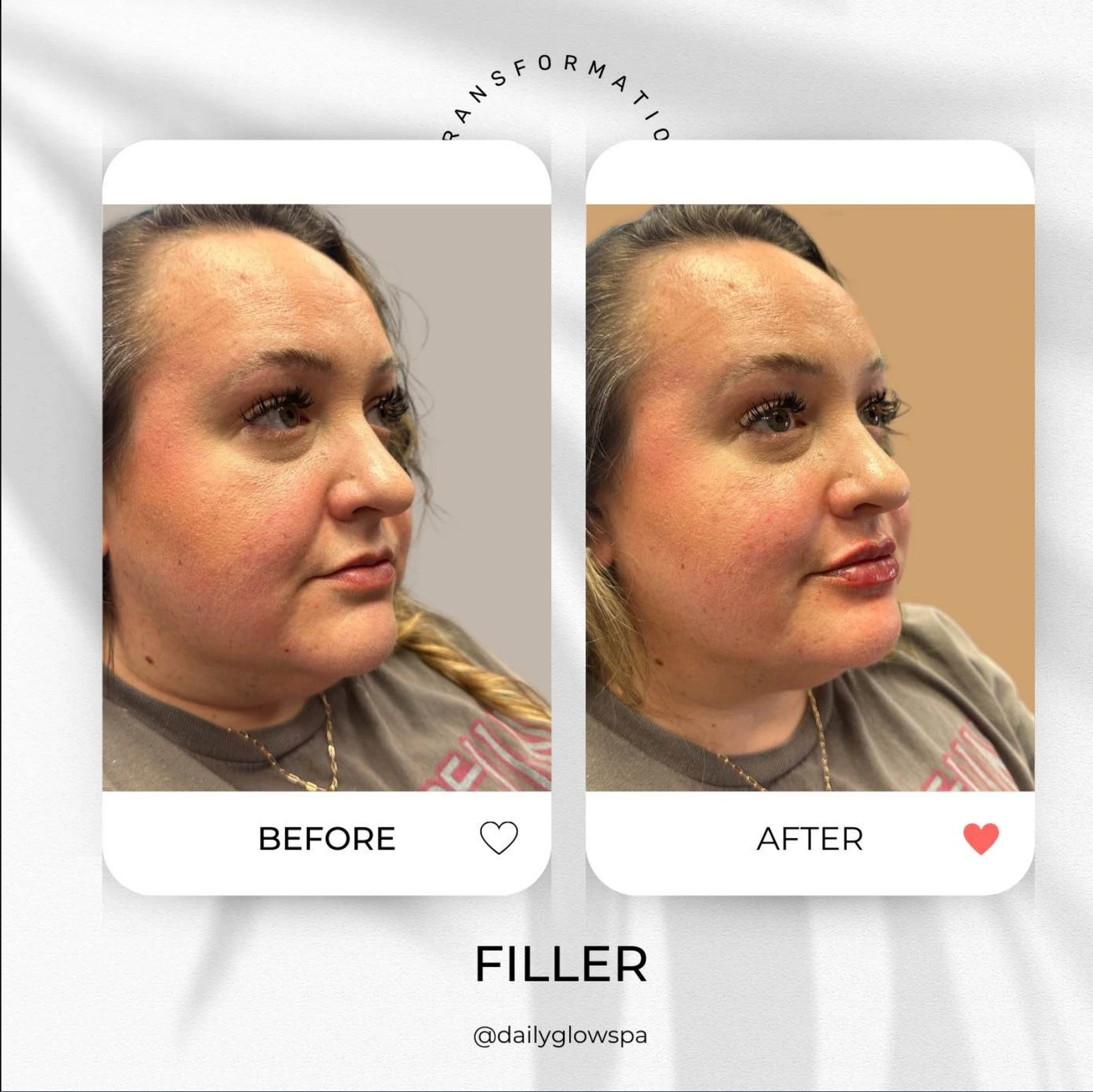 before-and-after